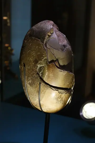 Bézoard lithofellique