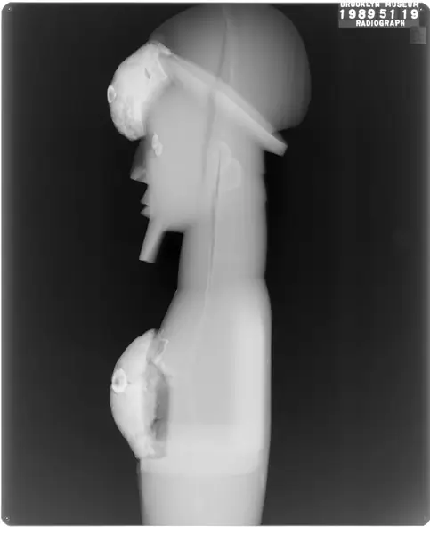 Figure of Standing Male (Nkisi)